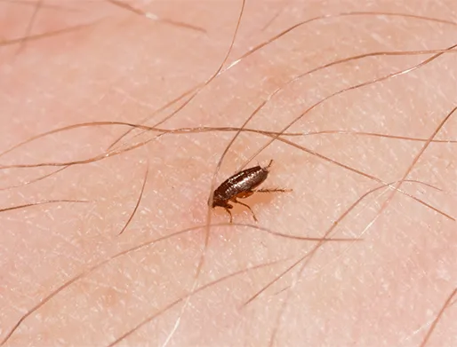 Dedetização de Pulgas em Monte Mor